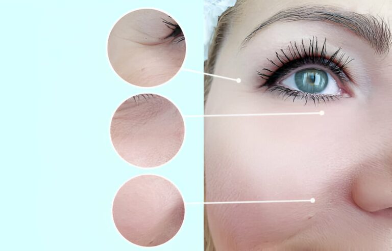 Botox and Beyond: How Cosmetic Procedures Enhance Overall Wellness