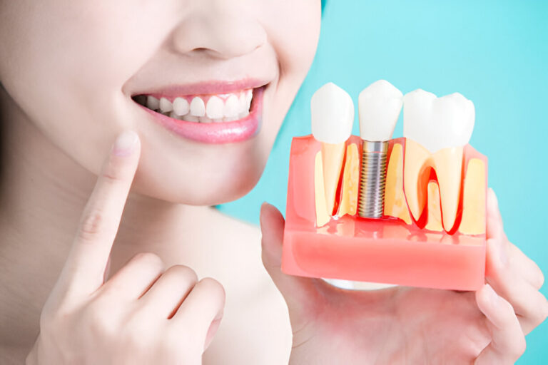 Unlocking the Benefits: Why Dental Implants Are the Best Solution for Missing Teeth