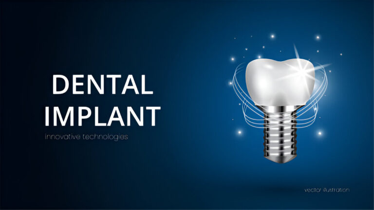 Innovations in Dental Implants