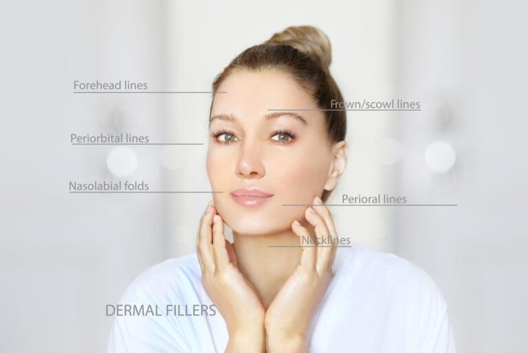 Popular Treatment Areas for Dermal Fillers